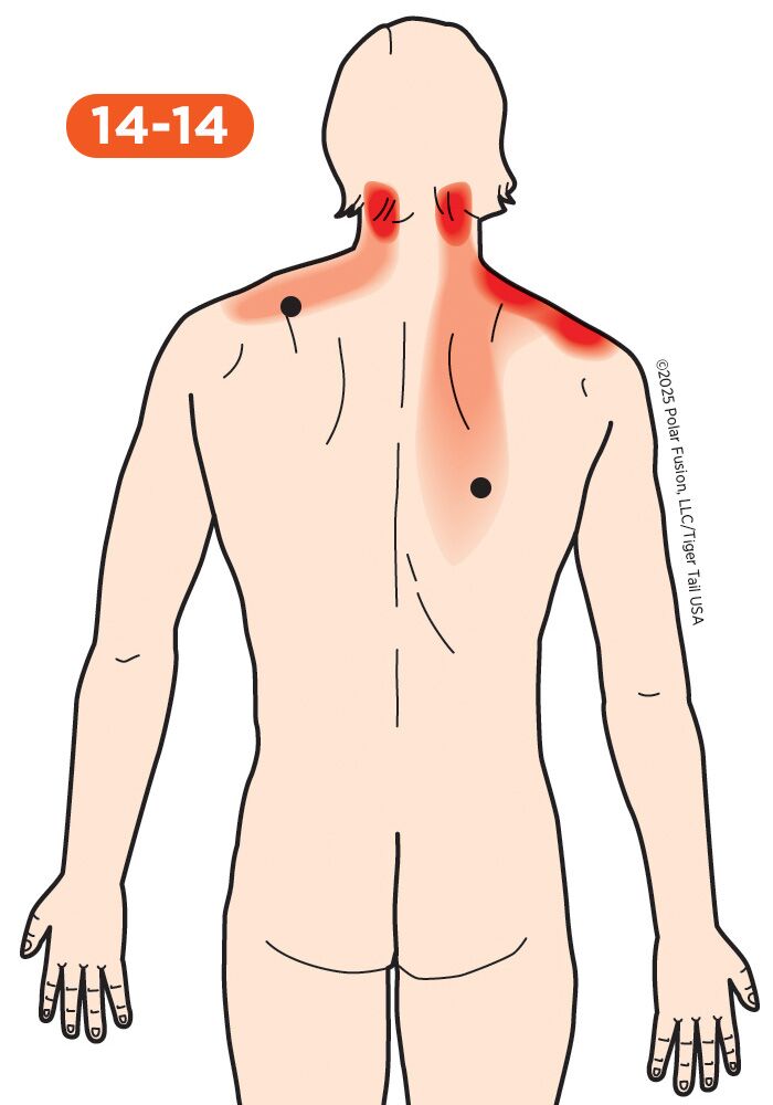 does pt141 cause backpain or myagia Parasympathetic and Sympathetic Nervous System Dysfunction and Monitoring PT-141 (Bremelanotide) Pros and Cons: