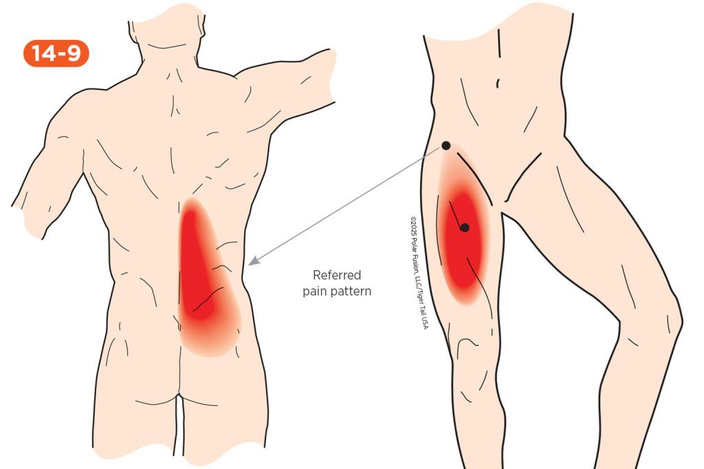 Back Pain: Causes, Relief & Self-Massage Guide | Tiger Tail USA